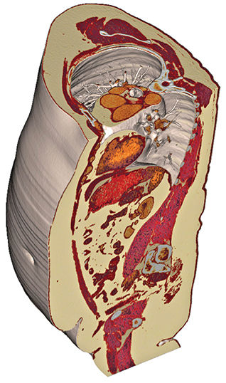 Sagittal Torso Section