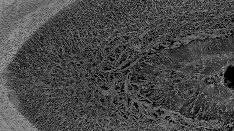 Cross section of rostral denticle