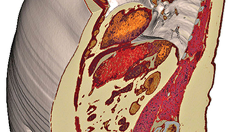 Sagittal Torso Section